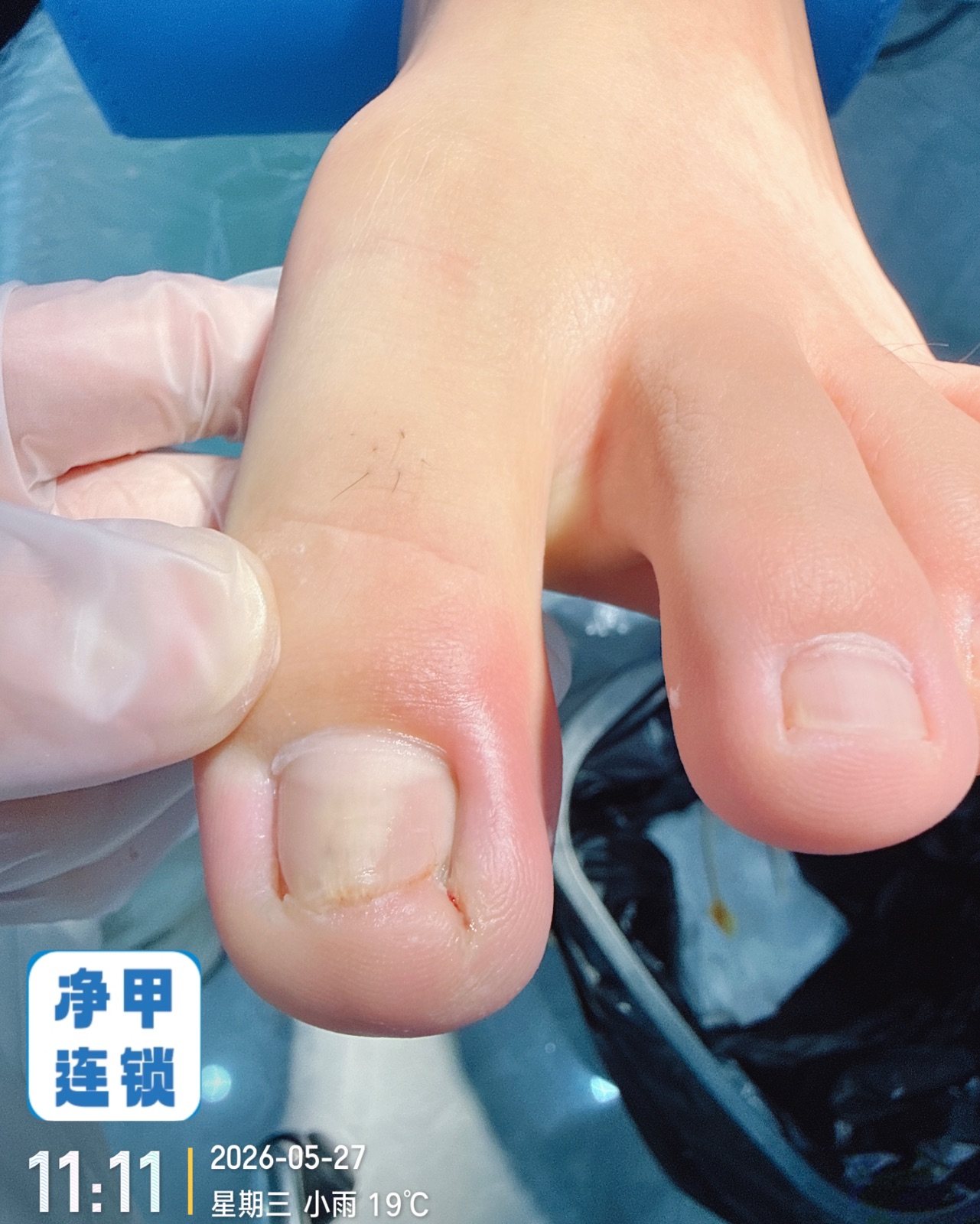 净甲连锁·新店开业 中药泡脚+专业修脚+润肤护理特价19元 康复全单八折 储值会员送价值98元脚气抑菌液