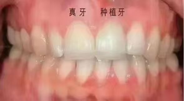 山东人从北京来到了岫岩，加微信惊喜多优惠多福利多